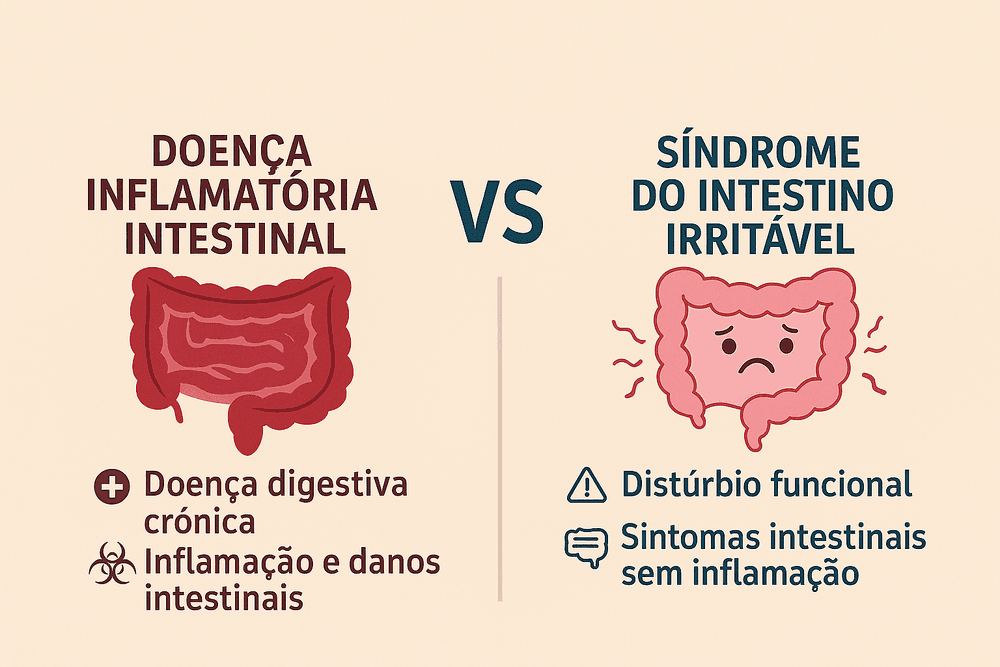 Infográfico explicando a diferença entre Doença Inflamatória Intestinal e Síndrome do Intestino Irritáve
