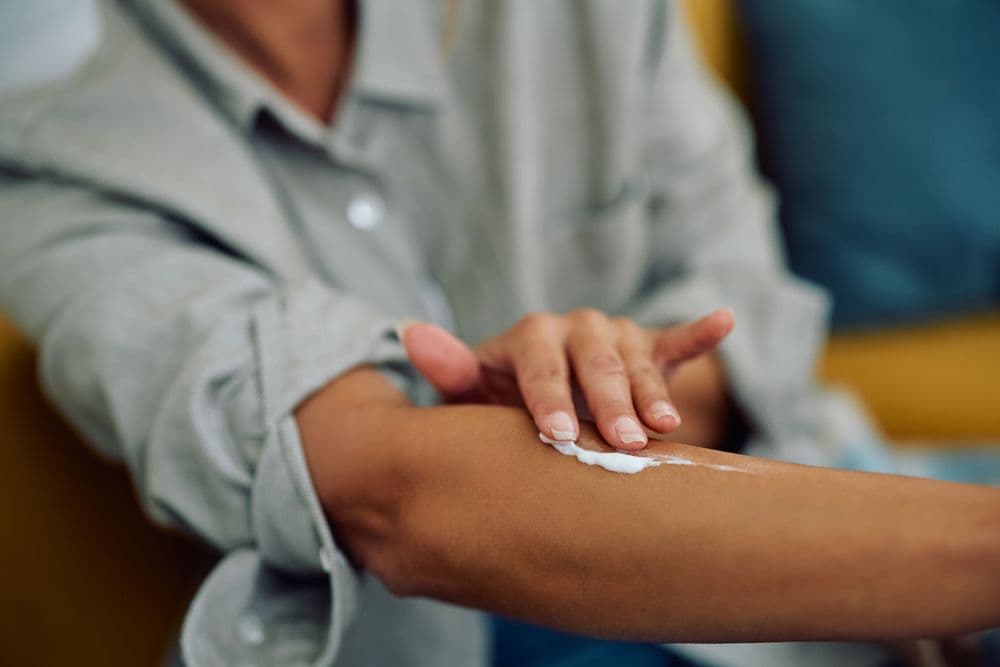 Cannabis medicinal no cuidado dermatológico: alívio para inflamações cutâneas