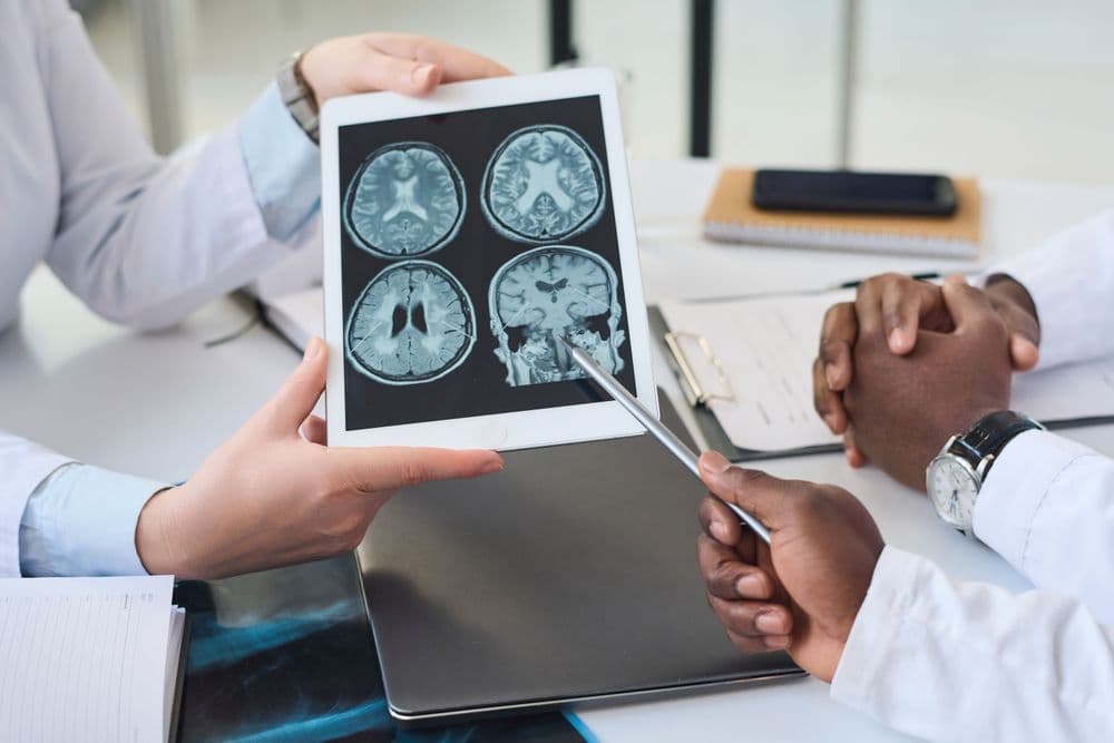 Três médicos examinando exames de ressonância magnética do cérebro em um tablet, discutindo as áreas afetadas.