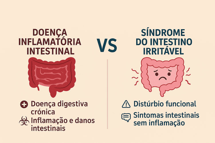 Infográfico explicando a diferença entre Doença Inflamatória Intestinal e Síndrome do Intestino Irritáve