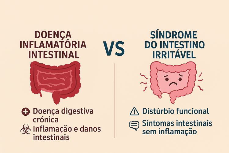 Infográfico explicando a diferença entre Doença Inflamatória Intestinal e Síndrome do Intestino Irritáve